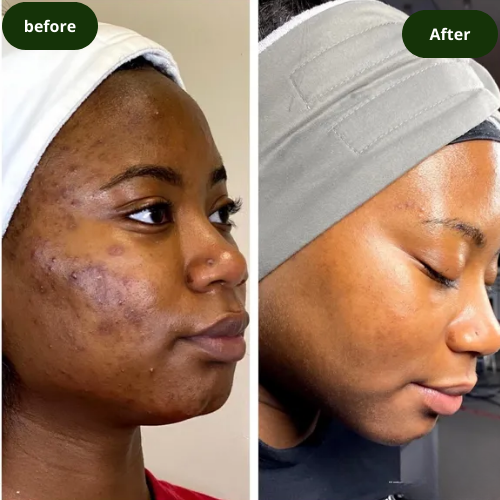 Glow Dark Spot Serum